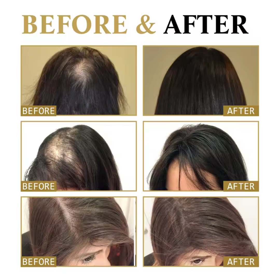 ZOZU™ Hair Growth Oil