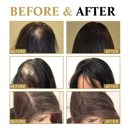 ZOZU™ Hair Growth Oil