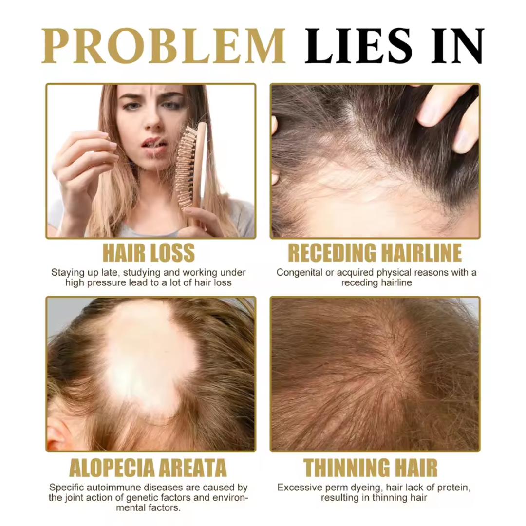 ZOZU™ Hair Growth Oil