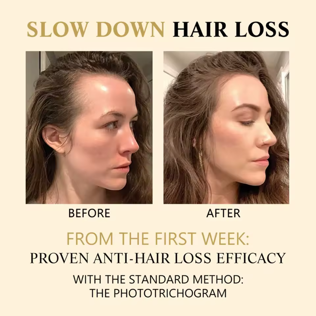 ZOZU™ Hair Growth Oil