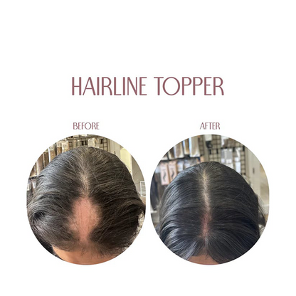 Hairline Booster Band – Limited Stock, Upgrade Your Look Today!🔥