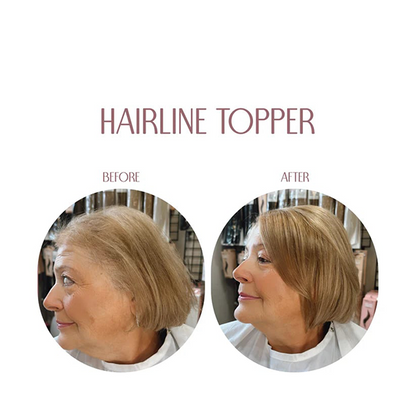 Hairline Booster Band – Limited Stock, Upgrade Your Look Today!🔥